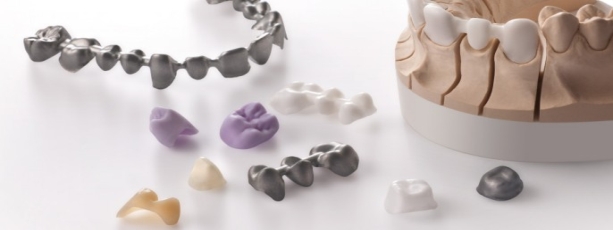 Quali sono i migliori materiali per gli impianti dentali? 